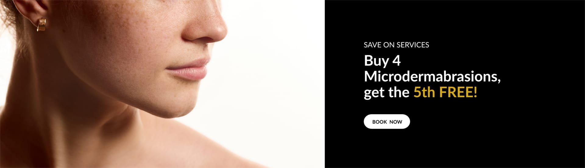Crystal Skin | Buy 4 Microdermabrasions and get 5th Free.