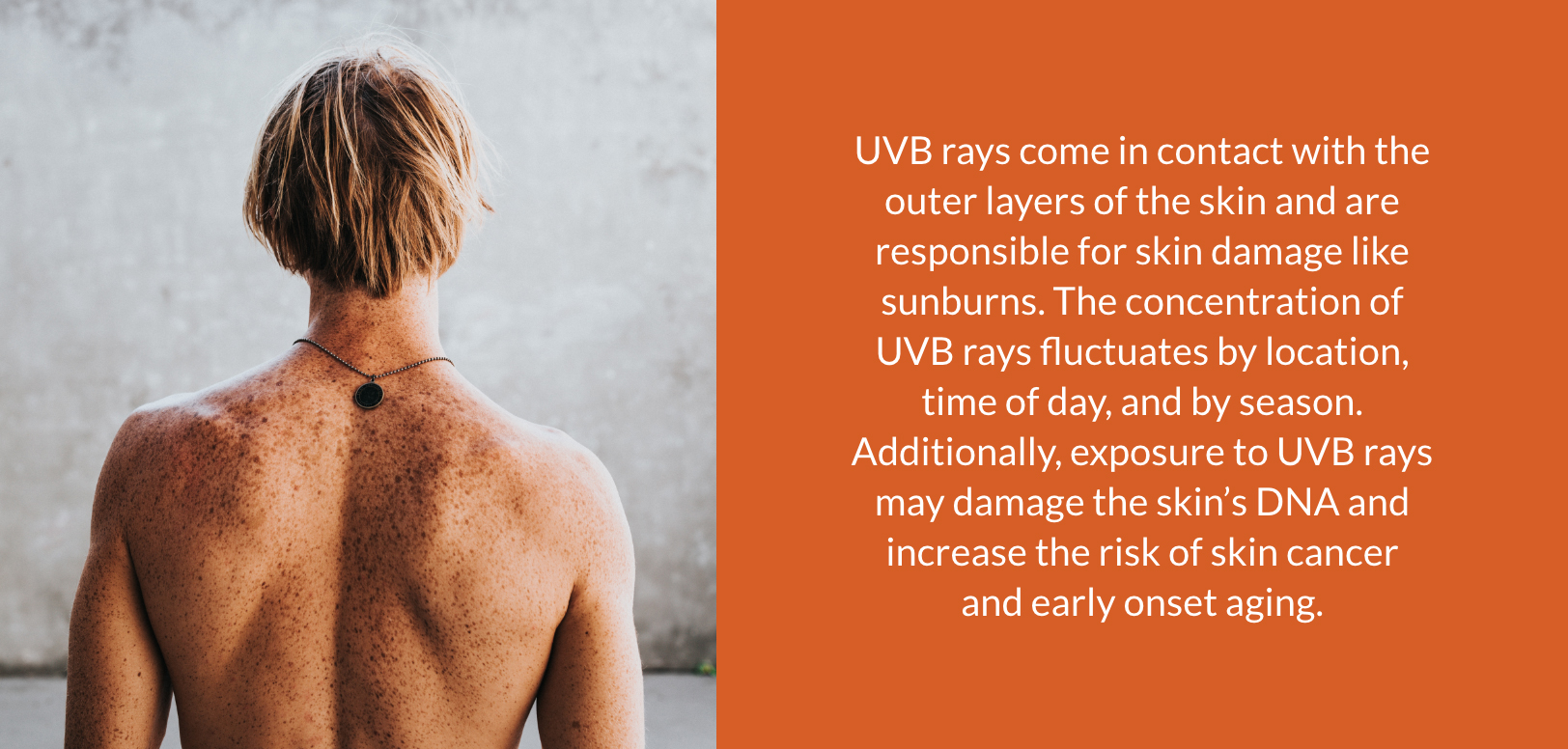 Sunscreen protects the skin from UVB rays.