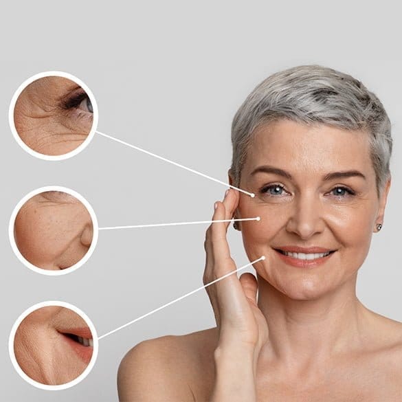 Opus Plasma Skin Tightening | Kaysville Utah by Crystal Skin