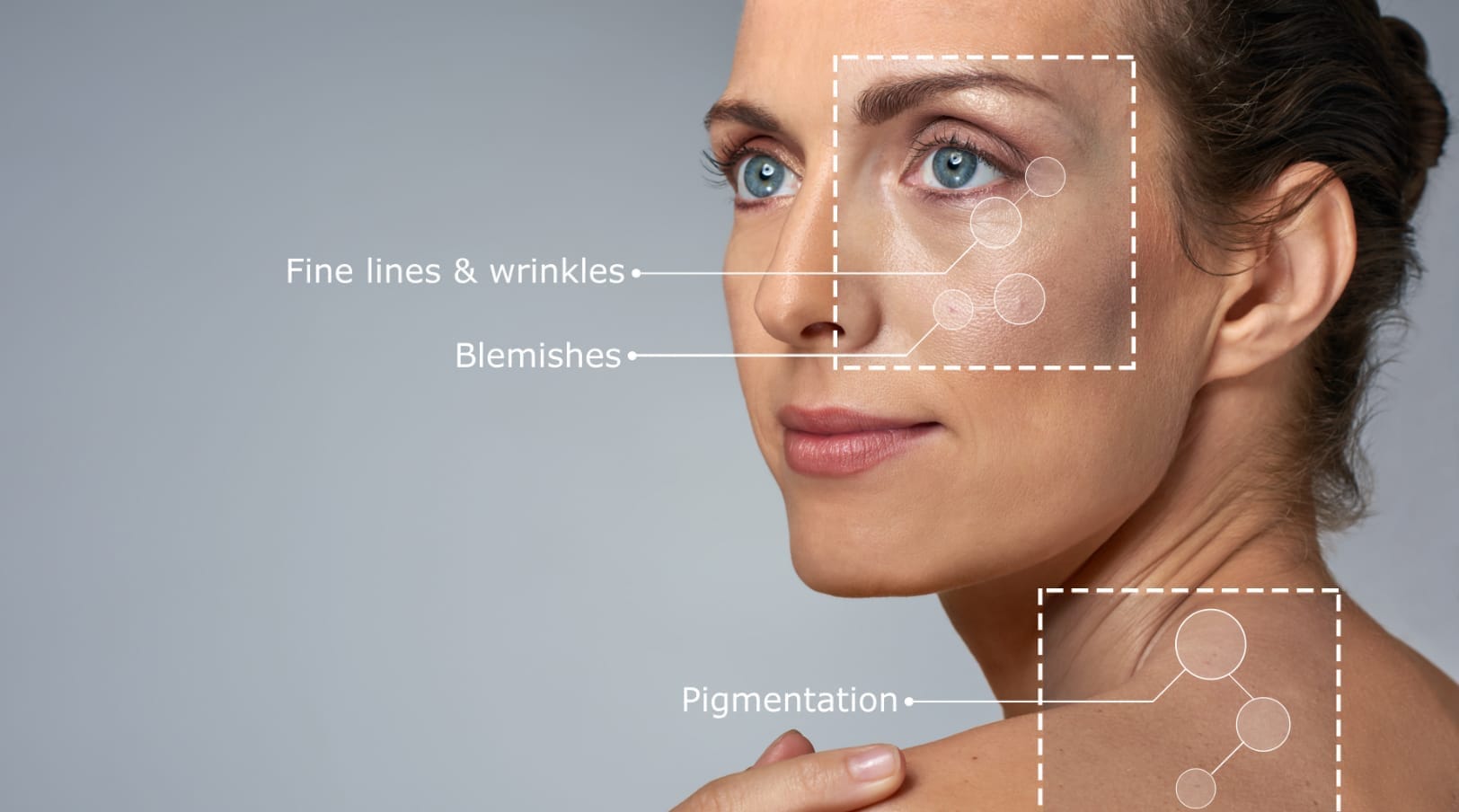 Opus Plasma Pre-treatment skin regimen | Kaysville Utah by Crystal Skin