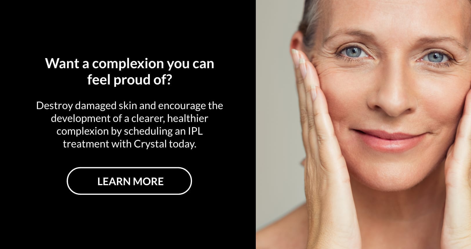 IPL Treatments Crystal Skin Utah